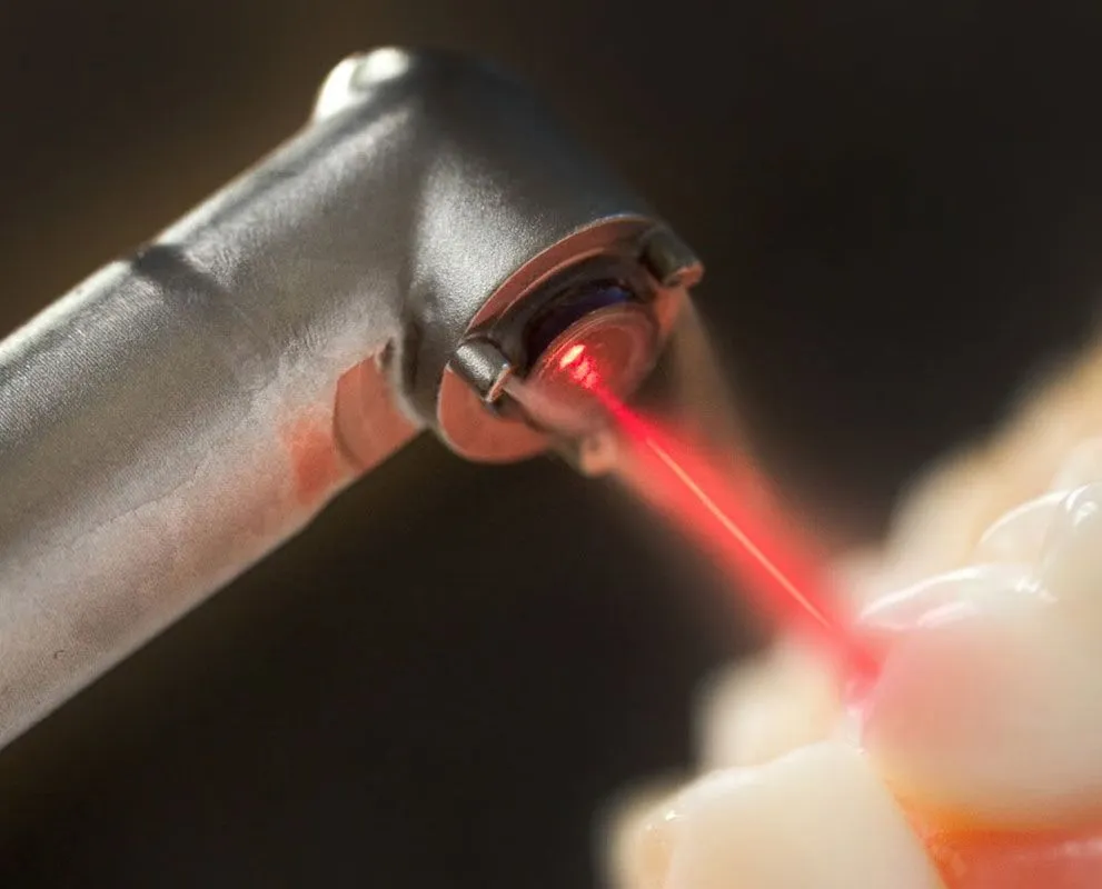 Most Advanced Dental Laser